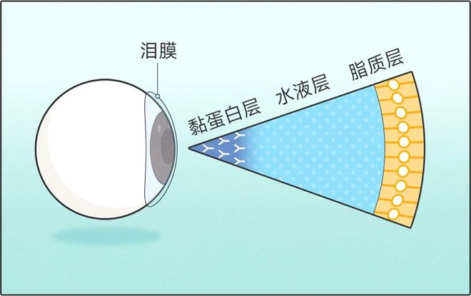 睛上！全国爱眼日必看急救包来了→尊龙凯时APP高考冲刺别毁在眼